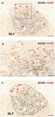 Ion channel profiles of extraocular motoneurons and internuclear neurons in human abducens and trochlear nuclei